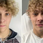 WHY IS WINTER the Perfect Time for Scar Camouflage in Indiana?